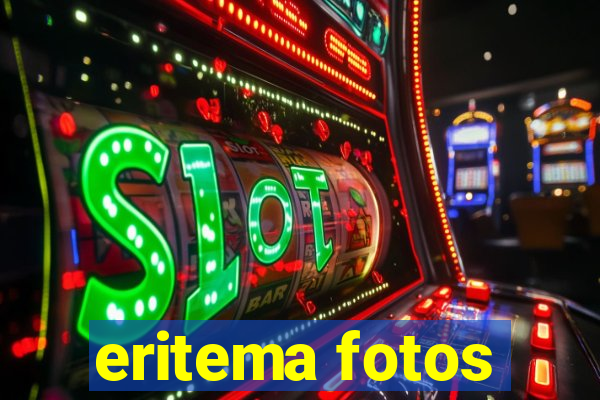 eritema fotos